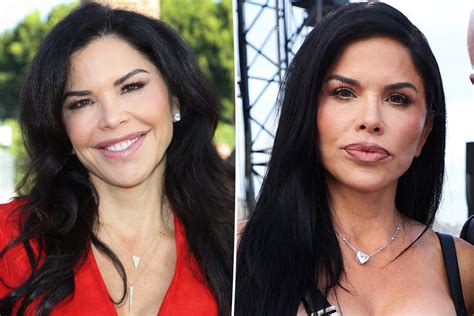 lauren sanchez surgery|Lauren Sanchez Plastic Surgery: Before and After ...